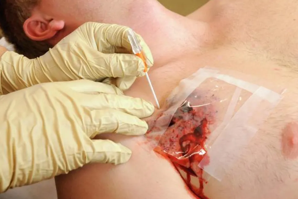 TyTek Medical TPAK neula
